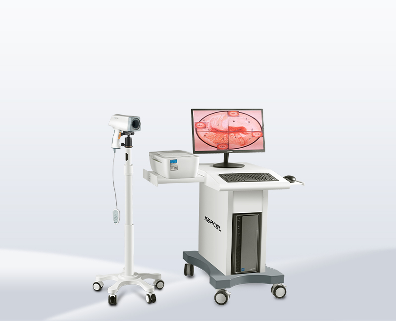 kn-2200 video colposcope