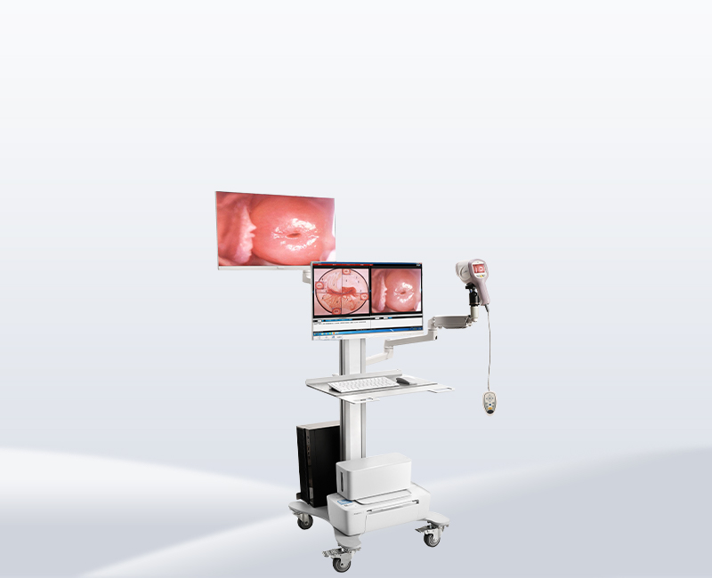 kn-2200i(h)video colposcope
