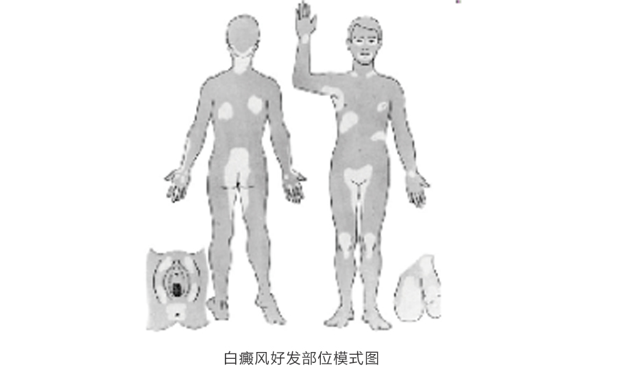 王宏伟教授专栏|白癜风相关知识科普(图1)